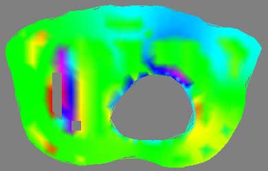 2D thorax data with colormap